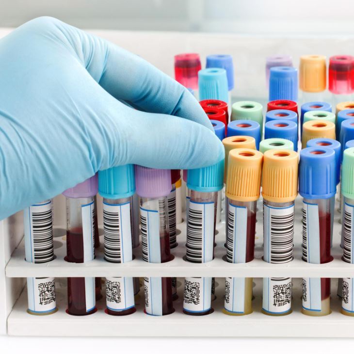 Ühekordselt kasutatav vaakum BD Vacutainer vere kogumise toru tootmisliin, le...