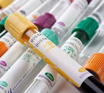 Vacutainer ühekordselt kasutatav haigla meditsiiniline roheline hepariin ster...